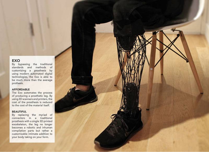 Illustration for article titled This Beautifully Minimalist Prosthetic Is Made From 3D Printed Titanium